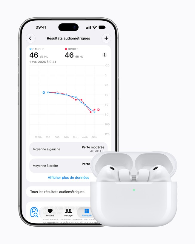 iPhone 18 Pro montrant la fonctionnalité d’audiométrie et ses résultats dans un graphique.