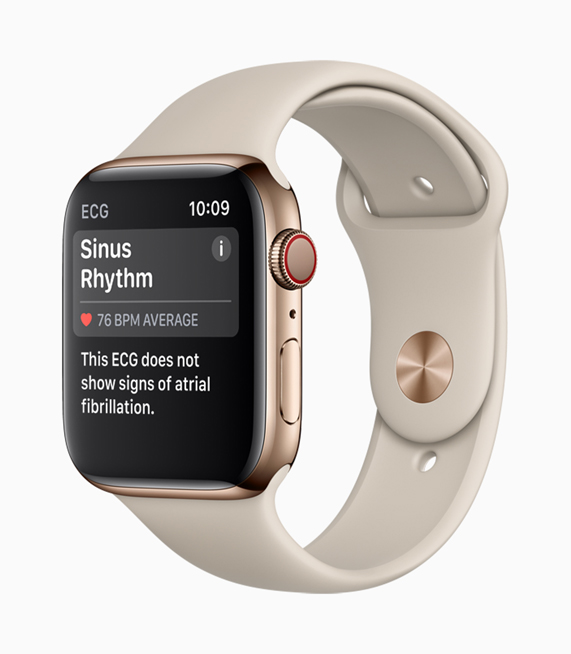 A results screen on Apple Watch Series 4 showing a Sinus Rhythm reading. 